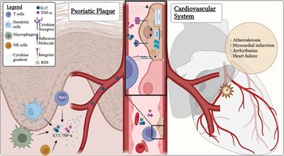 Psoriasis and Cardiovascular Diseases: An Immune-Mediated Cross Talk?